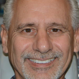John L. after restorative dental treatment in Pomona New York