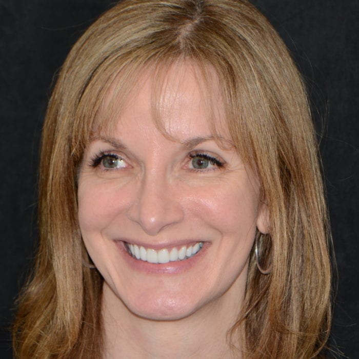 Family & General Dentistry in Rockland County NY Pomona