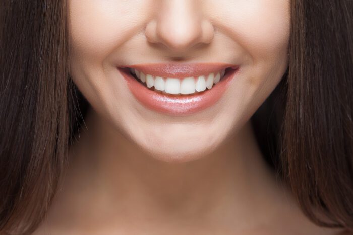 What is a Smile Makeover?