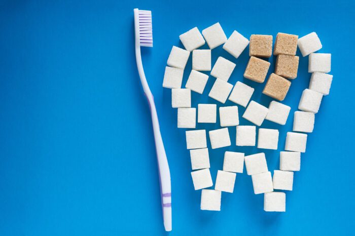 Does Sugar Cause Cavities?