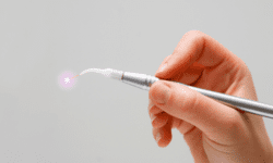 Why Laser Dentistry is a Big Deal in Rockland County, NY